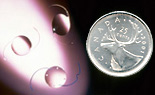 Intraocular Lens Implants IOLs